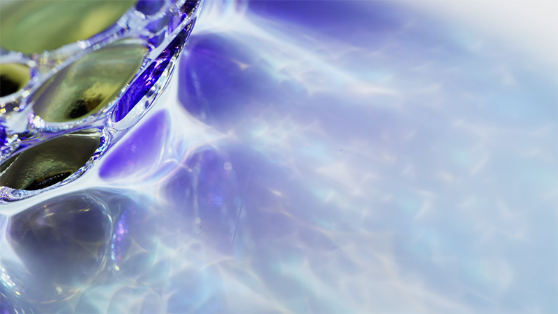 Reflexes 1